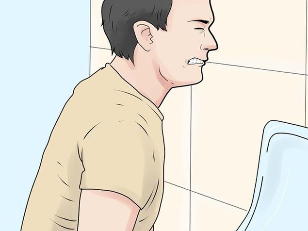 Pain during urination is a symptom of exacerbation of prostatitis in men. 