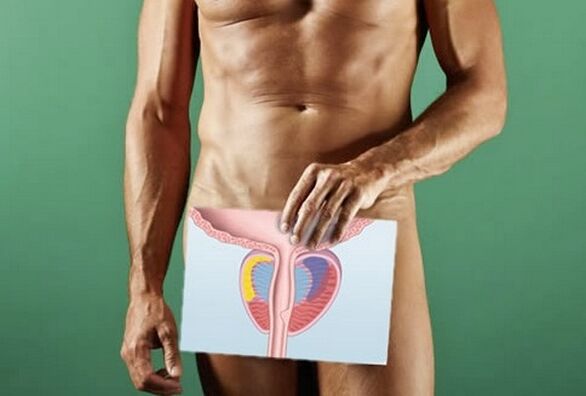 A man suffering from prostatitis.